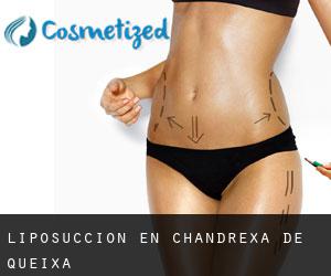 Liposucción en Chandrexa de Queixa