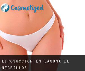 Liposucción en Laguna de Negrillos