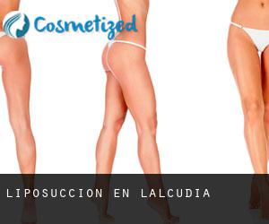 Liposucción en L'Alcúdia