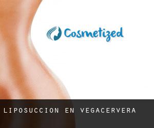 Liposucción en Vegacervera