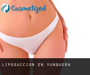 Liposucción en Yunquera