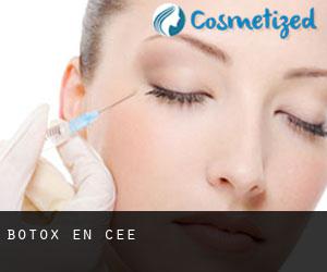 Botox en Cee