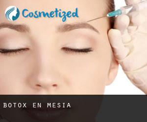 Botox en Mesia