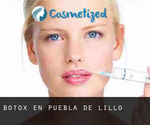 Botox en Puebla de Lillo