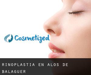 Rinoplastia en Alòs de Balaguer