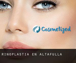 Rinoplastia en Altafulla