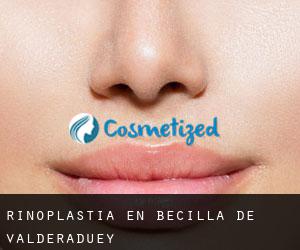 Rinoplastia en Becilla de Valderaduey