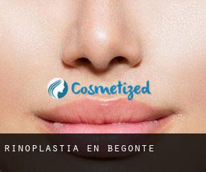 Rinoplastia en Begonte