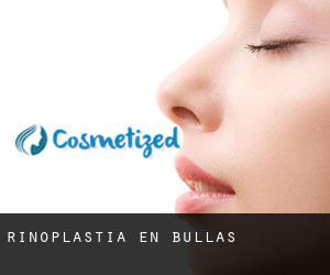 Rinoplastia en Bullas