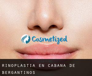 Rinoplastia en Cabana de Bergantiños