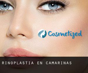 Rinoplastia en Camariñas