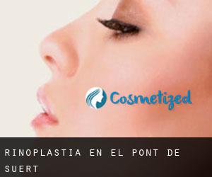 Rinoplastia en el Pont de Suert