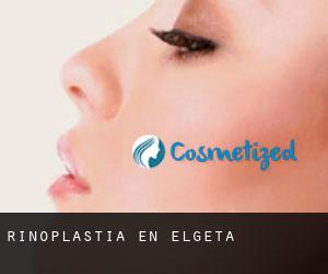 Rinoplastia en Elgeta