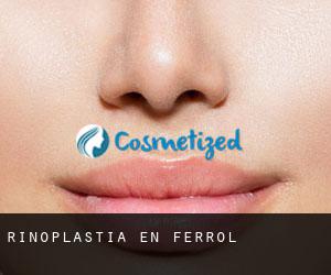 Rinoplastia en Ferrol