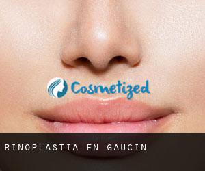 Rinoplastia en Gaucín