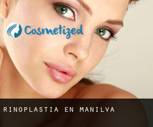 Rinoplastia en Manilva