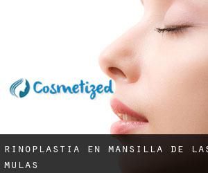 Rinoplastia en Mansilla de las Mulas