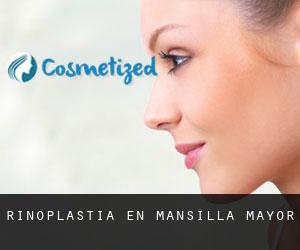 Rinoplastia en Mansilla Mayor