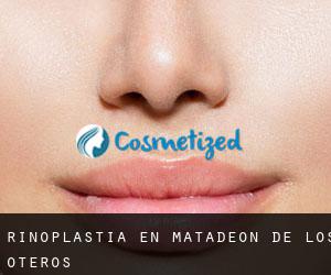 Rinoplastia en Matadeón de los Oteros