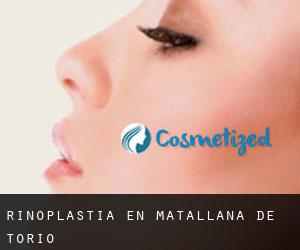 Rinoplastia en Matallana de Torío