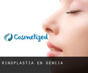 Rinoplastia en Oencia