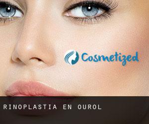 Rinoplastia en Ourol