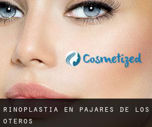 Rinoplastia en Pajares de los Oteros