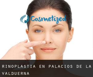 Rinoplastia en Palacios de la Valduerna