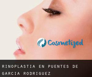 Rinoplastia en Puentes de García Rodríguez