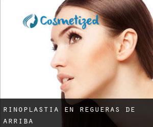 Rinoplastia en Regueras de Arriba