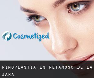 Rinoplastia en Retamoso de la Jara