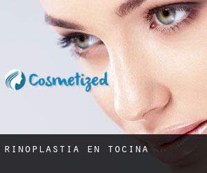 Rinoplastia en Tocina