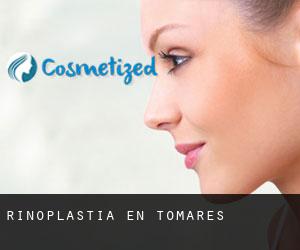 Rinoplastia en Tomares