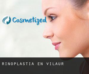 Rinoplastia en Vilaür