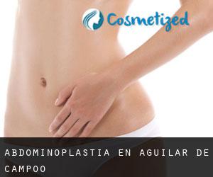 Abdominoplastia en Aguilar de Campóo