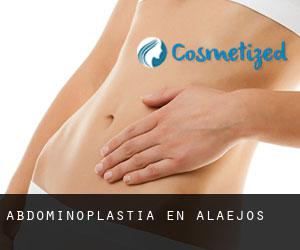 Abdominoplastia en Alaejos