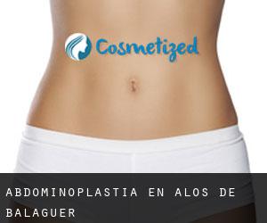 Abdominoplastia en Alòs de Balaguer