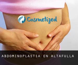 Abdominoplastia en Altafulla