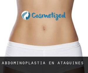 Abdominoplastia en Ataquines