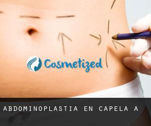 Abdominoplastia en Capela (A)