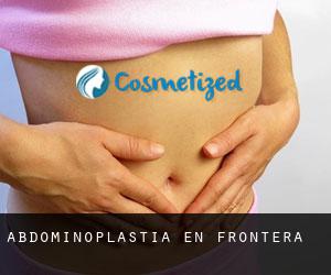 Abdominoplastia en Frontera