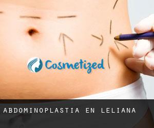 Abdominoplastia en L'Eliana