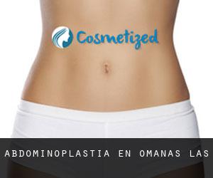 Abdominoplastia en Omañas (Las)