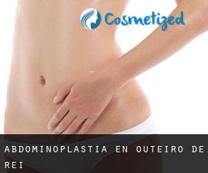 Abdominoplastia en Outeiro de Rei