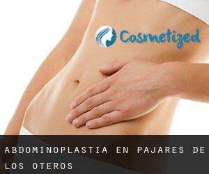 Abdominoplastia en Pajares de los Oteros