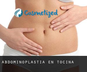 Abdominoplastia en Tocina